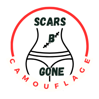 Scars B Gone